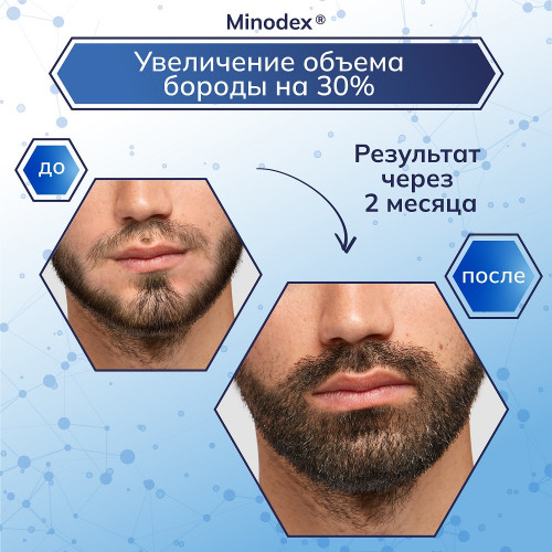 Лосьон для роста волос и бороды Minodex 15%, 6 флаконов и мезороллер