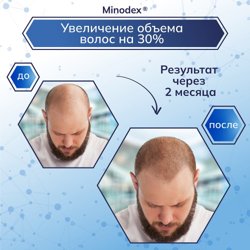 Лосьон для роста волос Minodex 15%